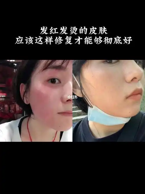 这几天来普陀山,太阳很大,也很热,我们一天都在山上,汗如雨下,皮肤也