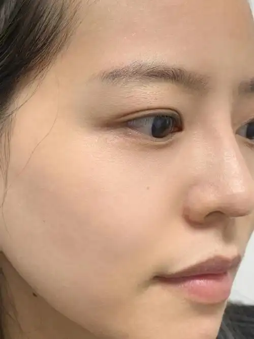 听劝不要什么都不懂就乱收缩毛孔