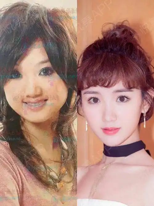 毛晓彤到底整了吗上