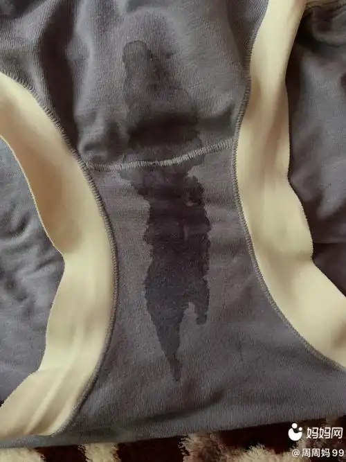 356周内裤突然湿了是内分泌还是羊水有过来人给我解释解释呗谢谢