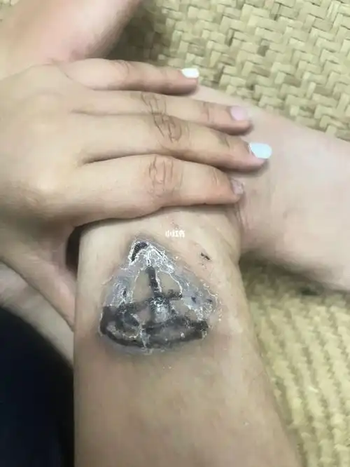 第二次洗纹身的恢复效果