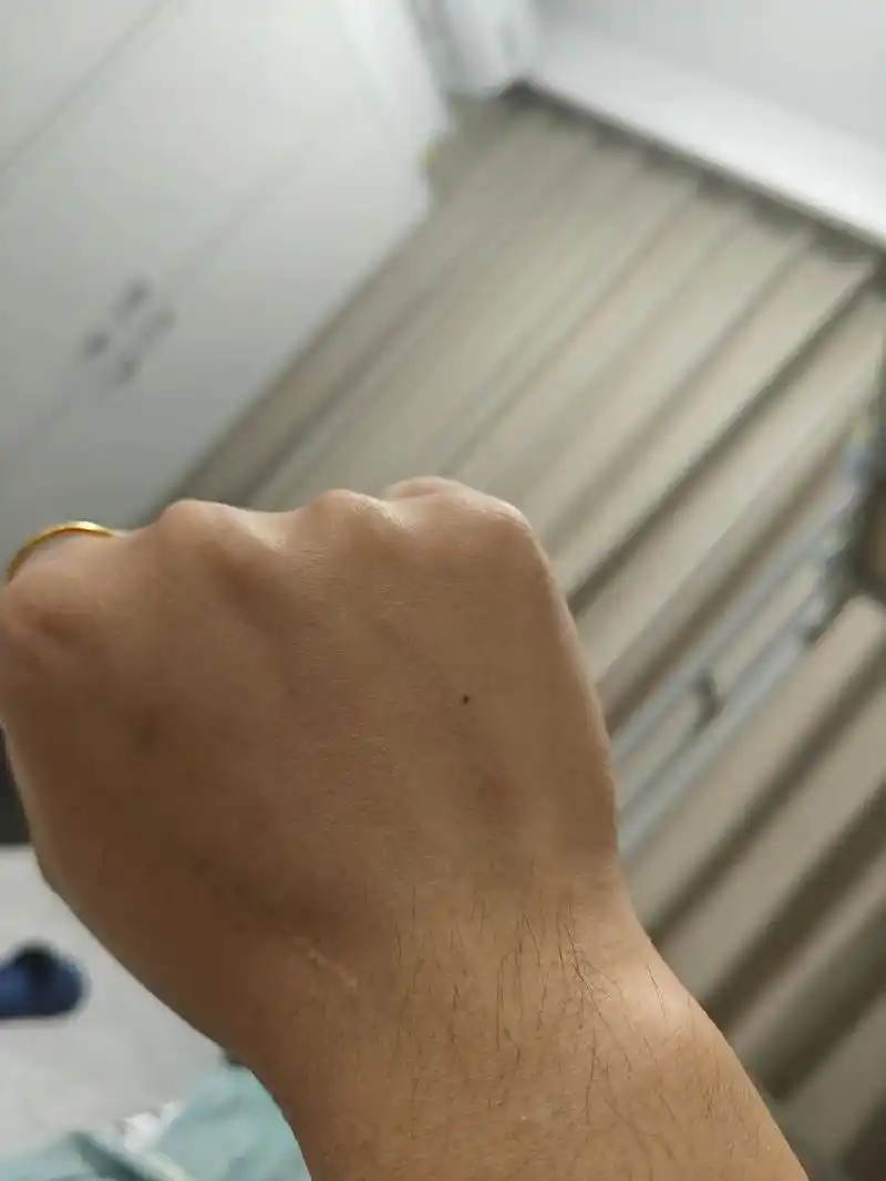 当你看向右手的时候,你的心中就已经有了一个身影#右手有痣 # - 抖音