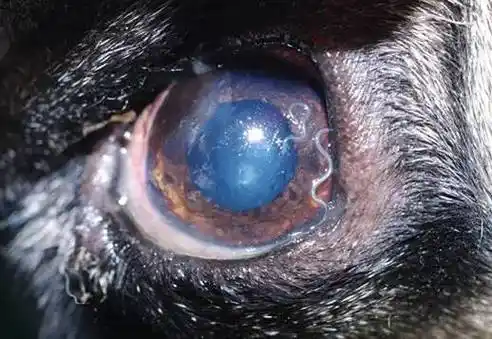 绍兴62岁大伯眼睛里爬出活虫子 原因竟是