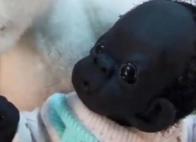 当年一出生全身发黑号称世界最黑婴儿如今5岁成怎样了