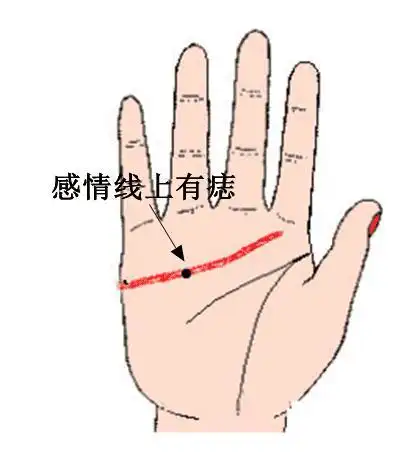 感情线上有痣好不好有什么说法