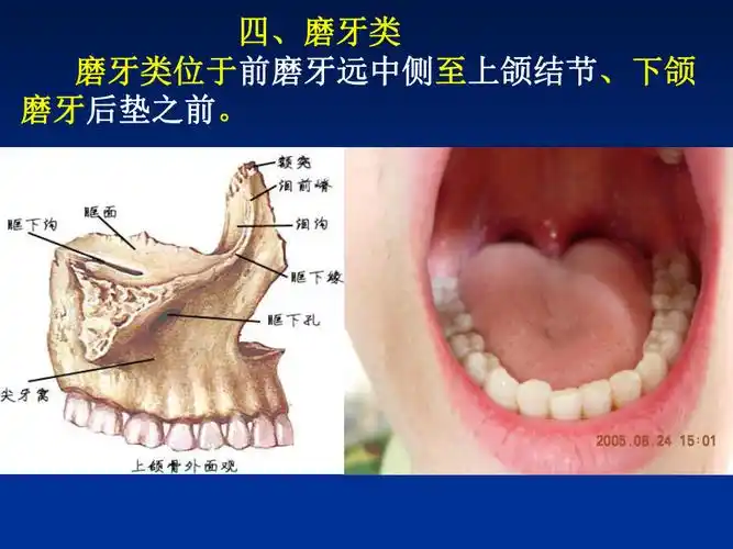 上颌磨牙解剖形态上6解剖形态经典实用