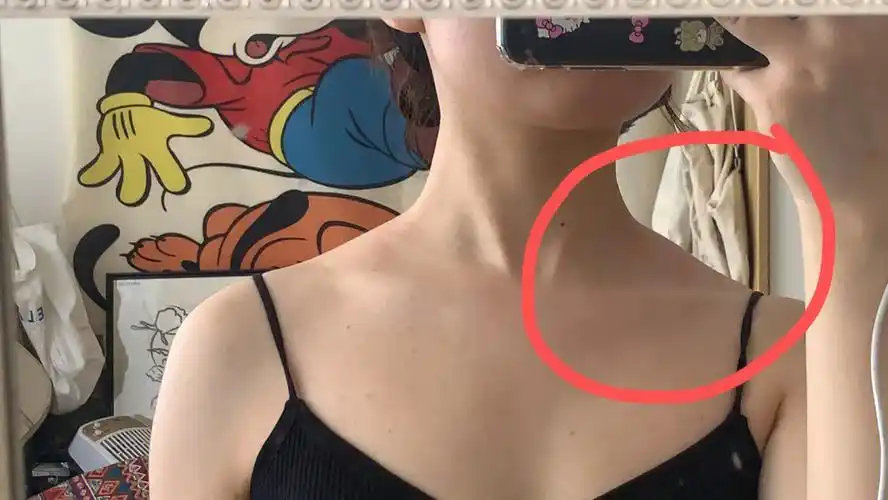 吉尼瘦背为什么斜方肌会变大呢