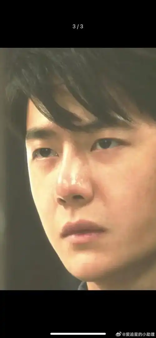 王一博新剧的鼻子状态被热议了看着很突兀吗