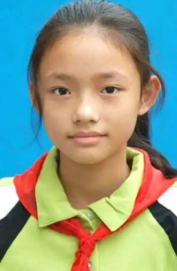 林允整容了吗林允童年照曝光女大十八变