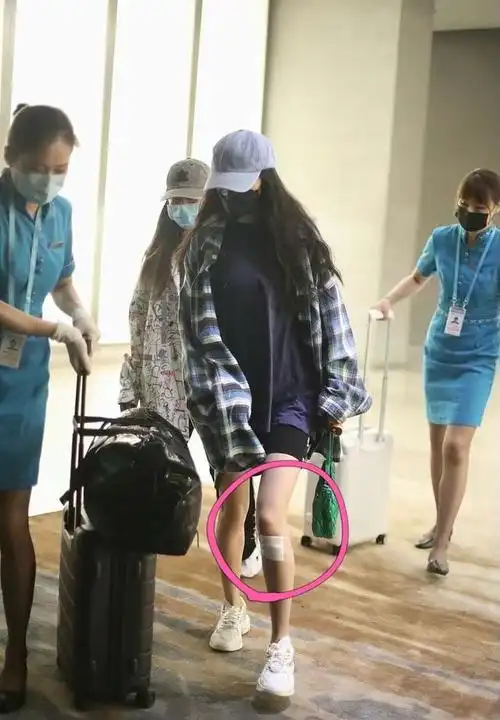 杨幂录密室不是第一次受伤,上次是腿,粉丝不满要求公开三大录像