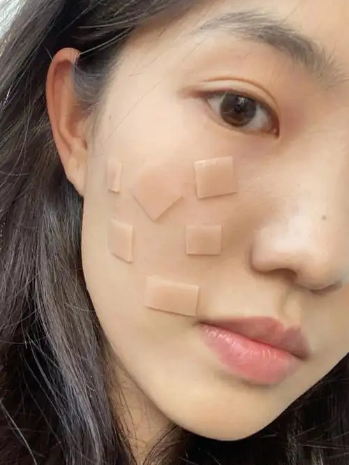 发现了去痘印的秘密方法啊啊啊