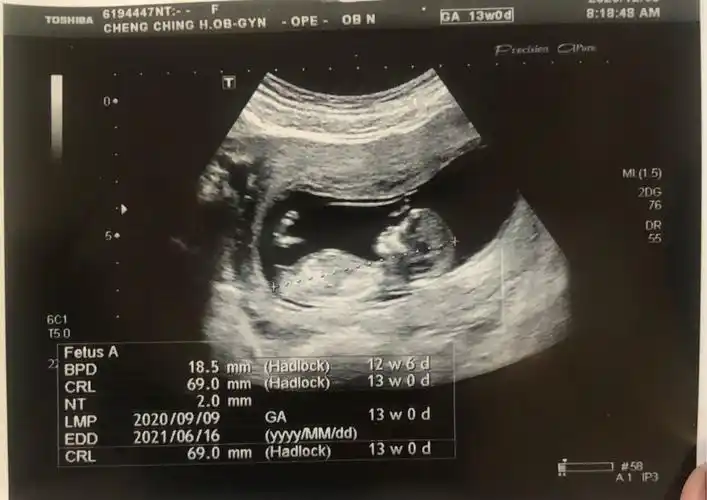 13周nt归来,有没有懂nub理论的姐妹帮看男女呢?