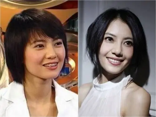 根本不同人6315 10位a咖明星『绑牙前后』大对比,网惊:牙齿影响好