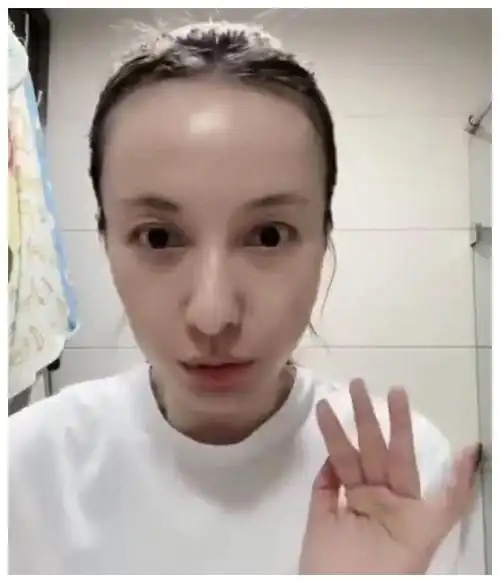 近照发际线后移额头光亮,被调侃快赶上杨幂了