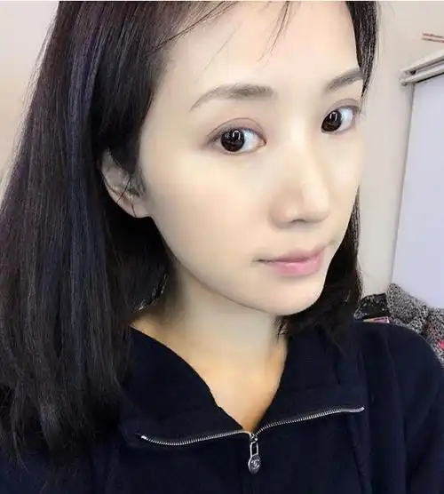 阔太李念曝皮肤白嫩素颜照 称靠吃猕猴桃保养