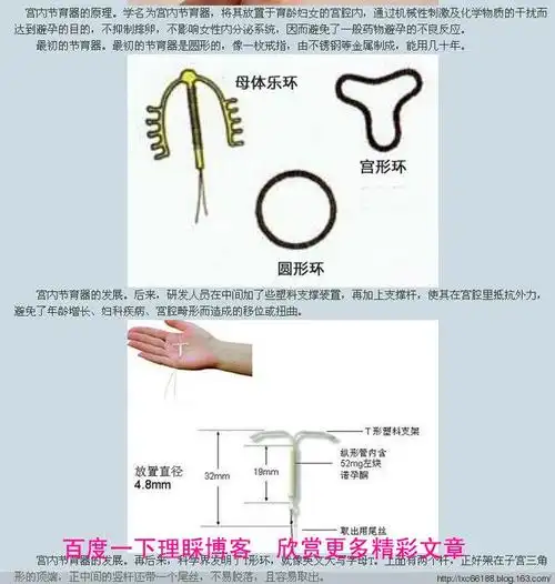 避孕环图女性上环图解