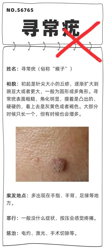 不要贴贴贴贴会传染得了皮肤疣一个传染俩