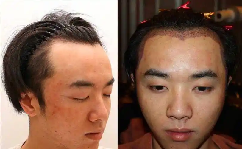 31岁华晨宇被造谣植发整容削骨,如何回应?张碧晨邓紫棋情感曝光