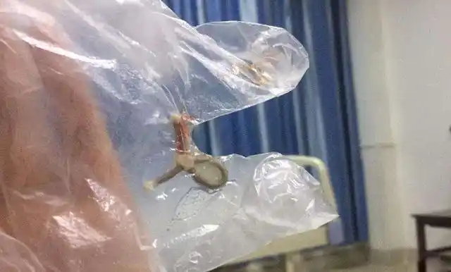 带节育环的女性,到这个年龄段就该取了,别等身体出问题才后悔