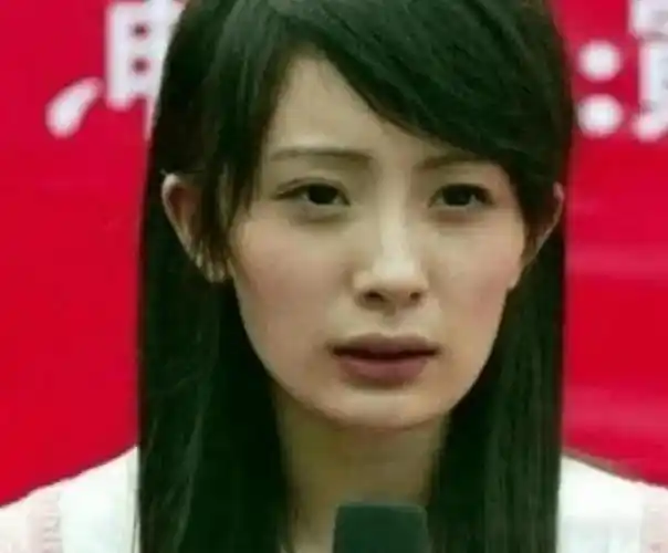 杨幂整容了吗?
