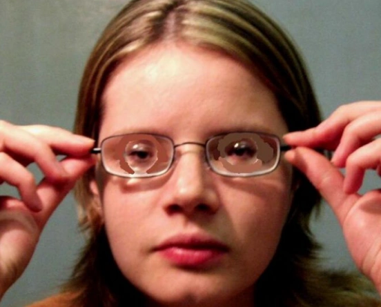 高度超高度近视需注意这些问题由于现在工作时间以及电脑使用时间超长