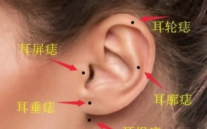 耳朵有痣,代表什么