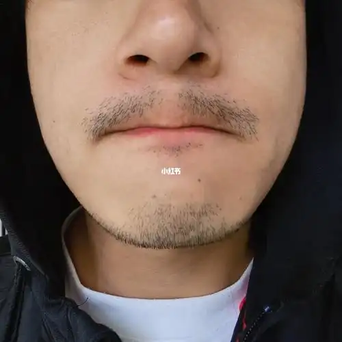 有什么办法让人中也长,不然留长了就是八字胡好难看啊.