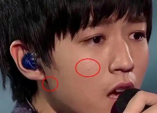 不看不知道,一看吓一跳,这脸上坑坑洼洼的