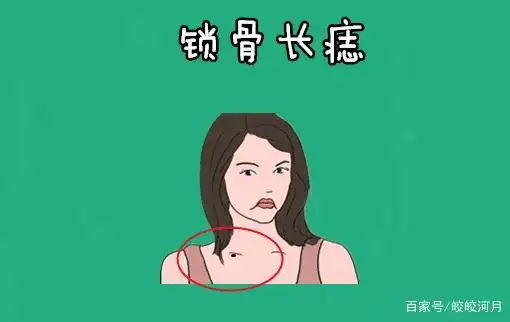 身体4颗倒霉痣,破财添灾,霉运不断,只能化解,不能点掉!