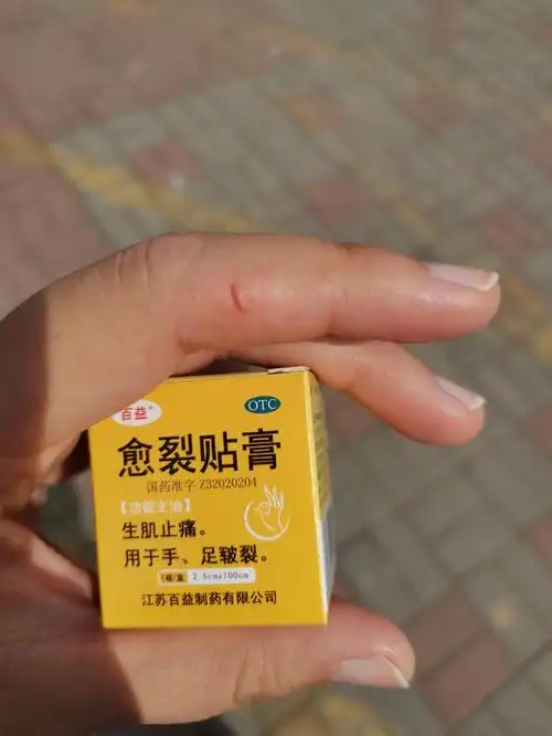 手裂口子愈裂贴膏试试