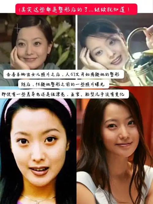 金喜善说自己没整过,是骗人的