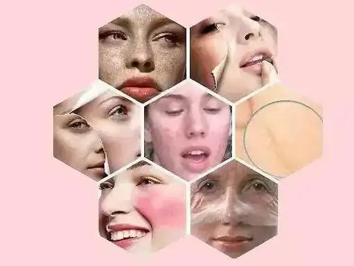 好好爱自己,从重视皮肤屏障开始