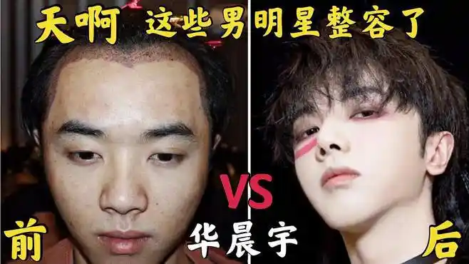 男星整容前后对比,华晨宇蜕变男神,古巨基甄子丹堪称换脸-娱乐视频