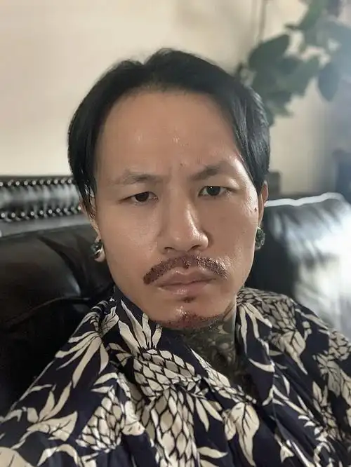 今天和大家分享一下我胡须种植的情况,感觉这两年很流_圈子-新氧美容