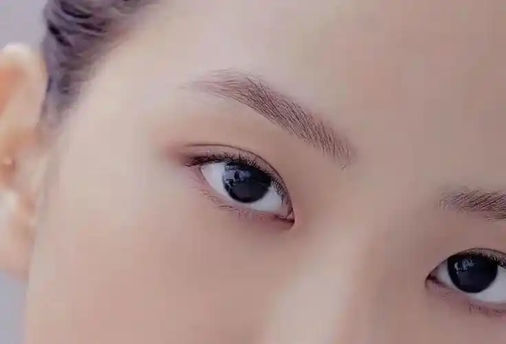 双眼皮可以自然到什么程度自然的双眼皮有什么类型的