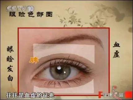 健康眼睑标准顺序进行因次,要依次按这五个层次来观察第五层是瞳孔第