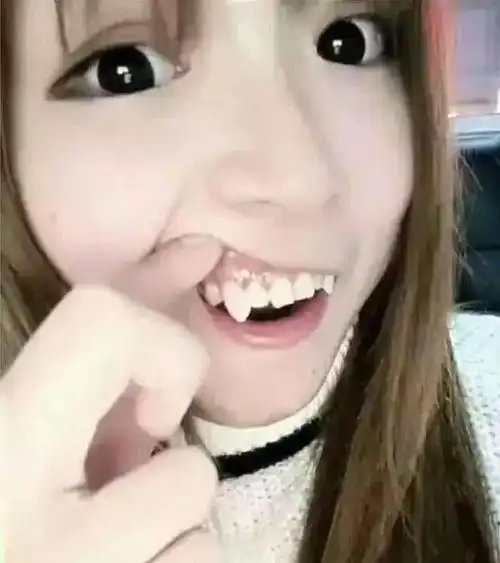 6,小妹妹虎牙长的着实吓人