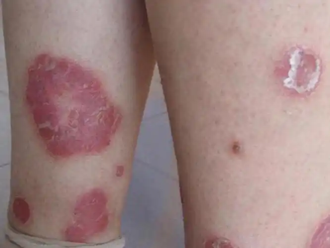 艾滋病病毒感染者女性艾滋病感染者图片