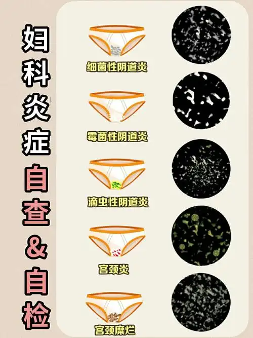 现在想想真的是自己平时的不注意才造成了各种妇科疾病789090