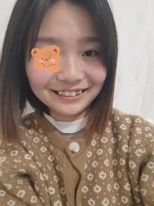 好想知道虎牙矫正要多长时间啊!