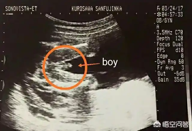 胎儿性别是什么时候形成的有何科学依据