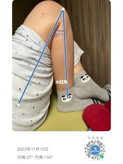 后弯腿手能够到伤腿的脚了,下蹲伤腿的痛感也已经降低了,俯卧掰腿弹力