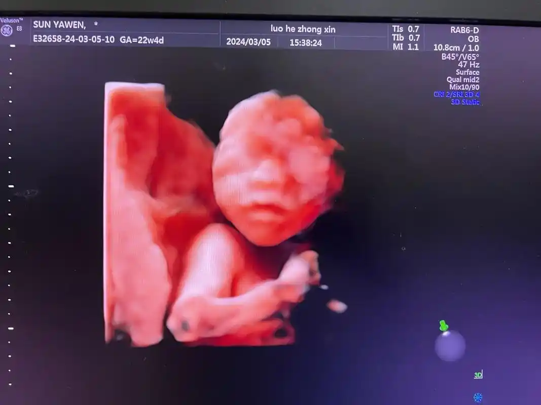 今日份官宣06 你好呀,我的小云朵93 记录你的第