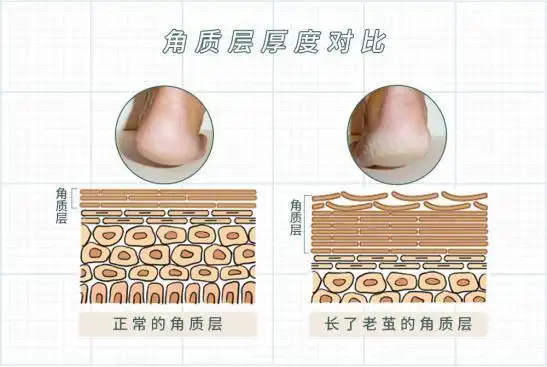 为啥女孩子身体,都是白白嫩嫩滑滑的啊?_澎湃号·湃客_澎湃新闻-the p