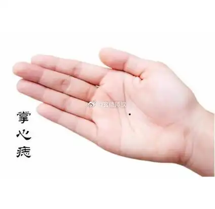 若手背有一颗小巧的黑色痣,则表示此人心地善良,与佛有缘.