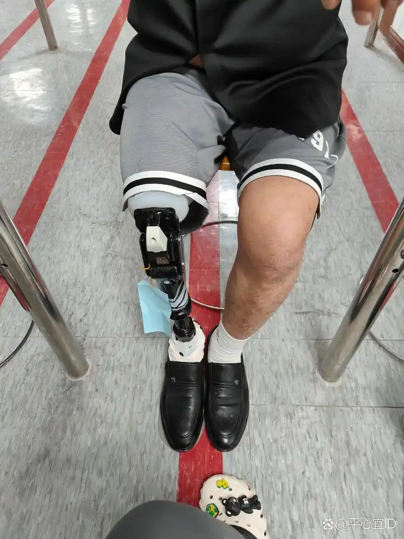出用了两个多月的大腿假肢,价格很合理,质量保证一点问题都没有.