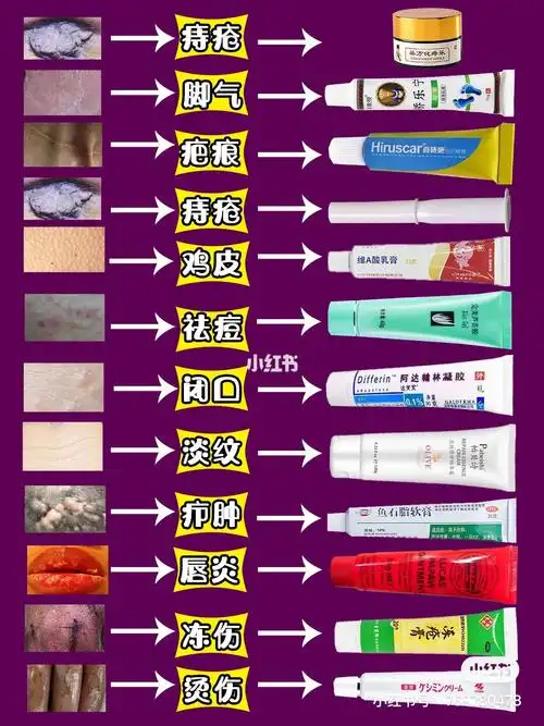 自用皮肤药膏大全,用对√不踩雷 痔疮——巢方化痔乐 脚气——矫乐宁