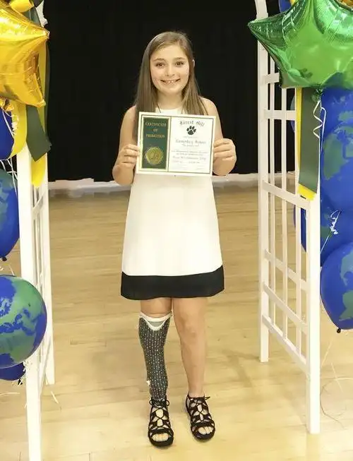 11岁残疾小女孩笑对生活用义肢跳芭蕾并获奖