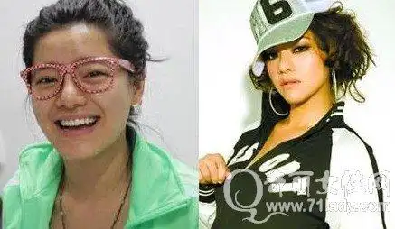 江映蓉整容前后对比照片