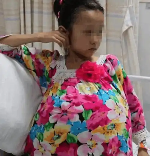 12岁少女怀上怪胎 生下10斤肉球还有骨头和毛发
